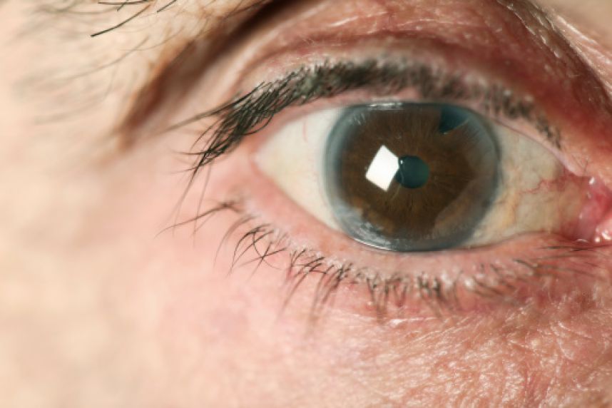 glaucoma-sintomas