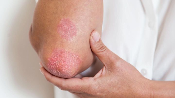 whats-causing-your-skin-rash-05-rm-1440x810